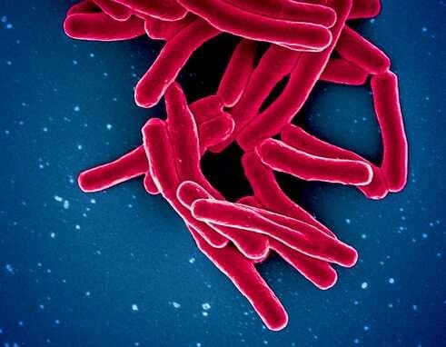 Illustration representing Tuberculosis